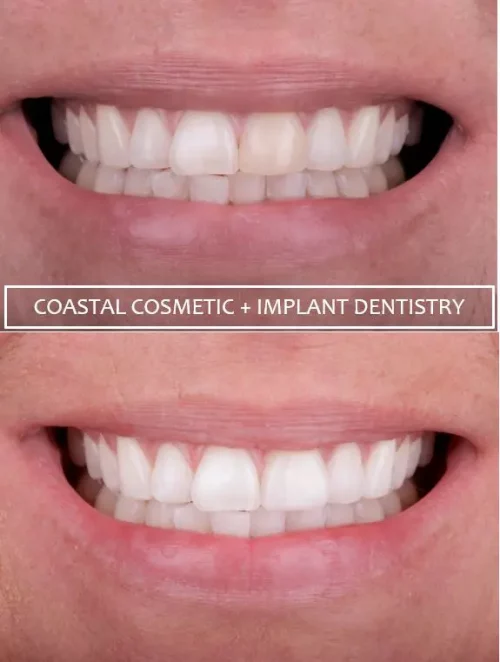 Before dental services at Coastal General Dentistry