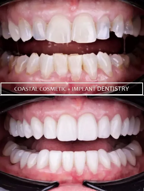 Before dental services at Coastal General Dentistry