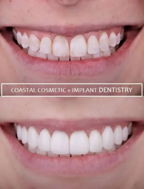 Before dental services at Coastal General Dentistry