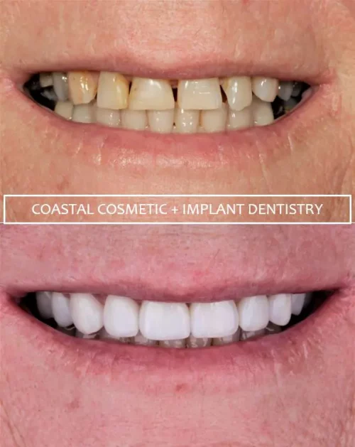 Before dental services at Coastal General Dentistry