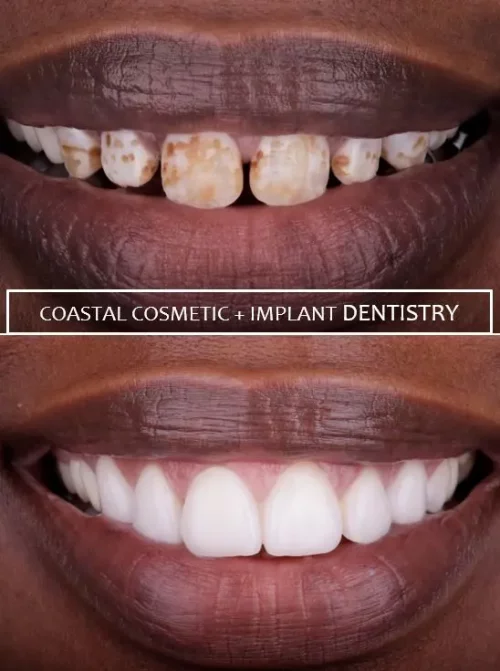Before dental services at Coastal General Dentistry
