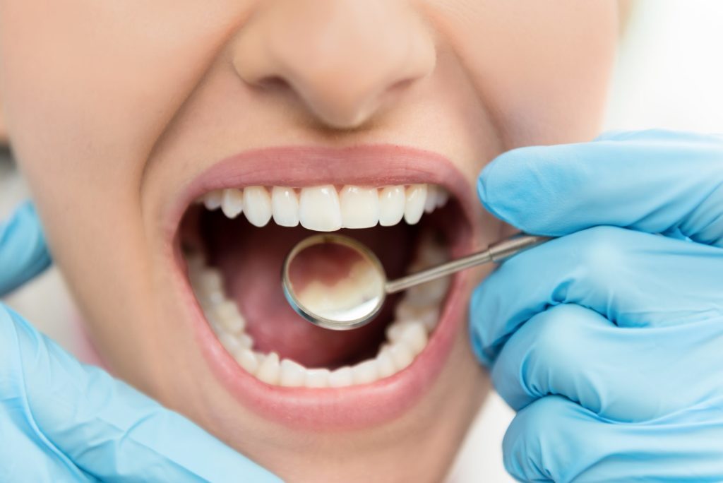 Tooth abscess treatment in Virginia Beach, VA